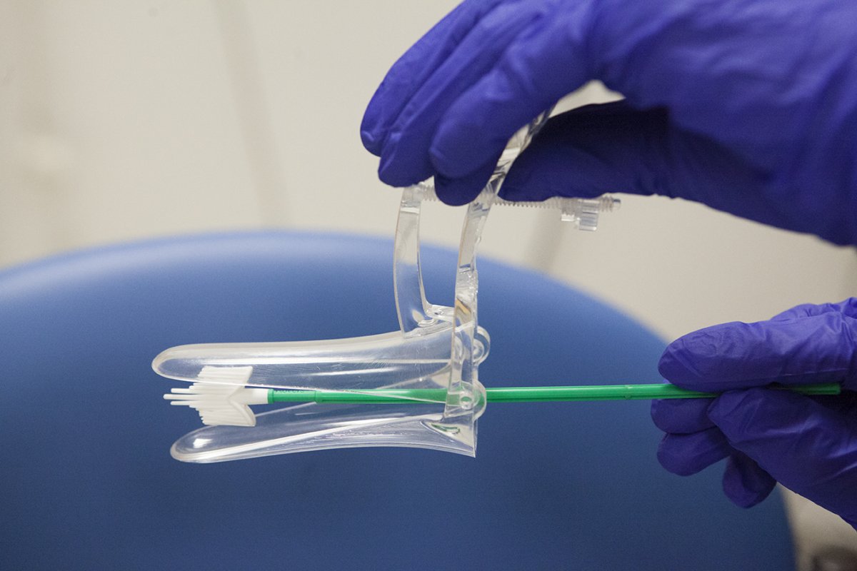 smear testi nedir