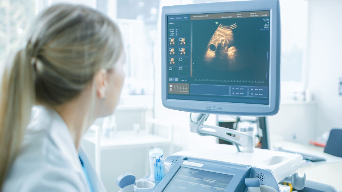 Esenyurt'ta 11-14 hafta muayenesi sırasında yapılan ultrasonografi görüntülemesi.
