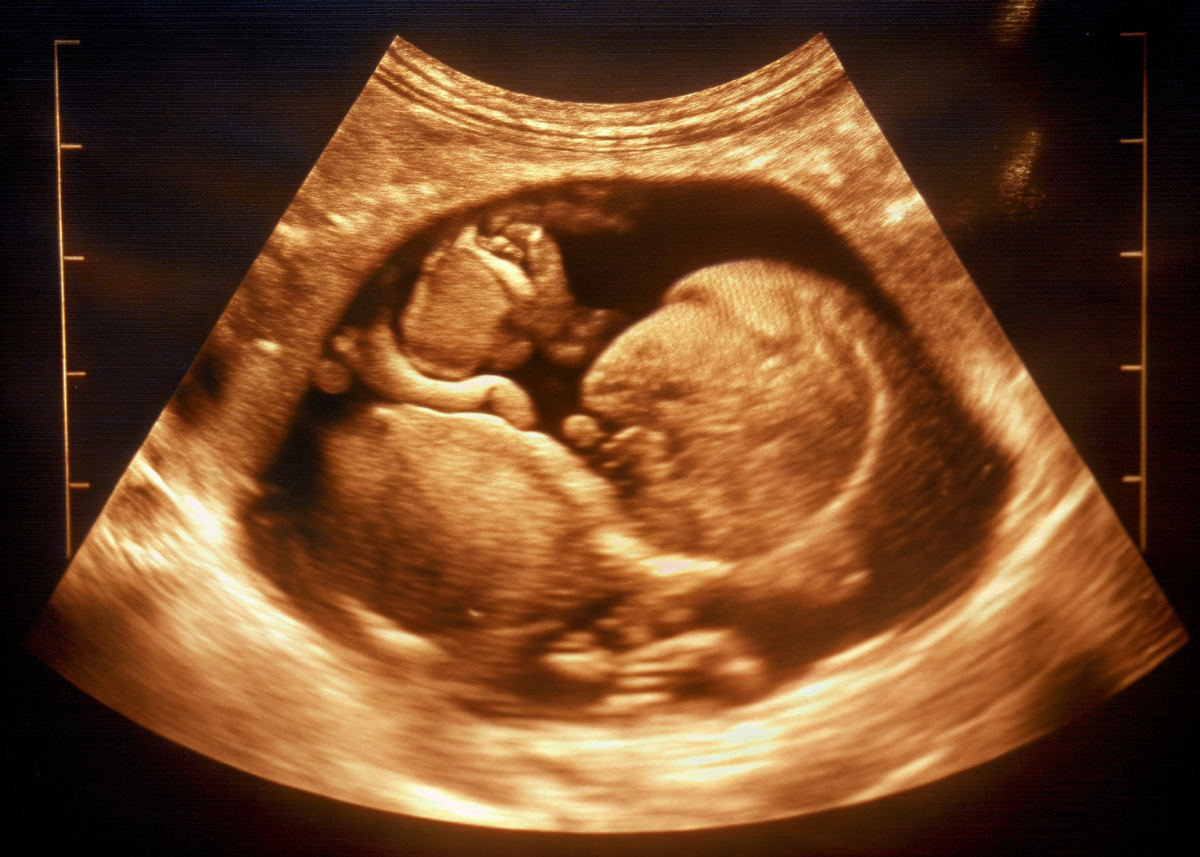 Ayrıntılı ultrason cihazında plasenta yerleşimi ve bebek gelişimi muayenesi görüntüsü.